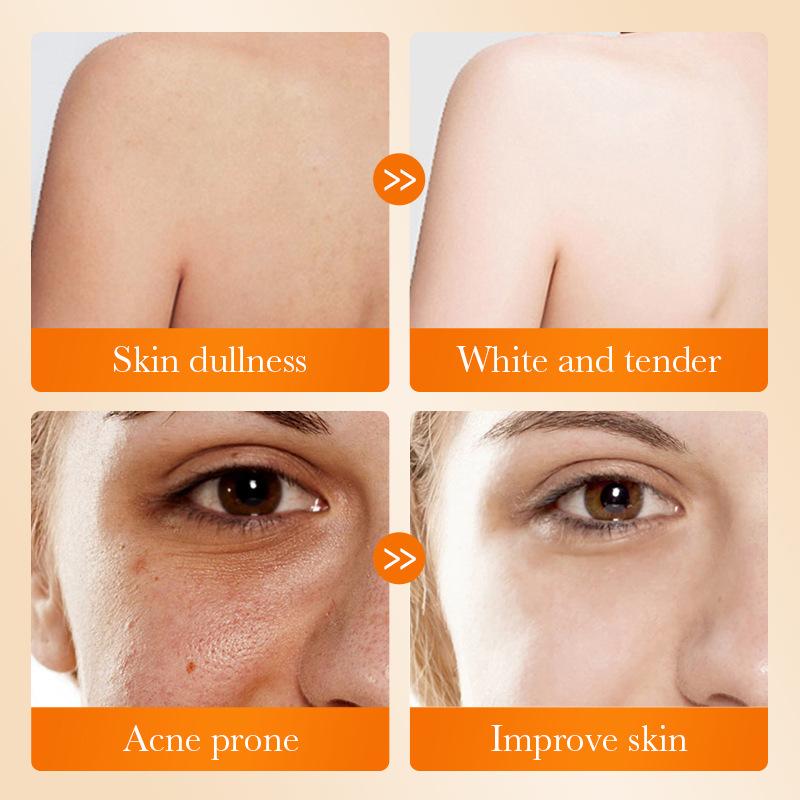 1Pc SADOER 코직산 페이셜 비누 페이스 워시 폼 - Kojic Acid Soap 리뷰 및 가격